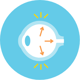 Steroid overexposure can cause glaucoma